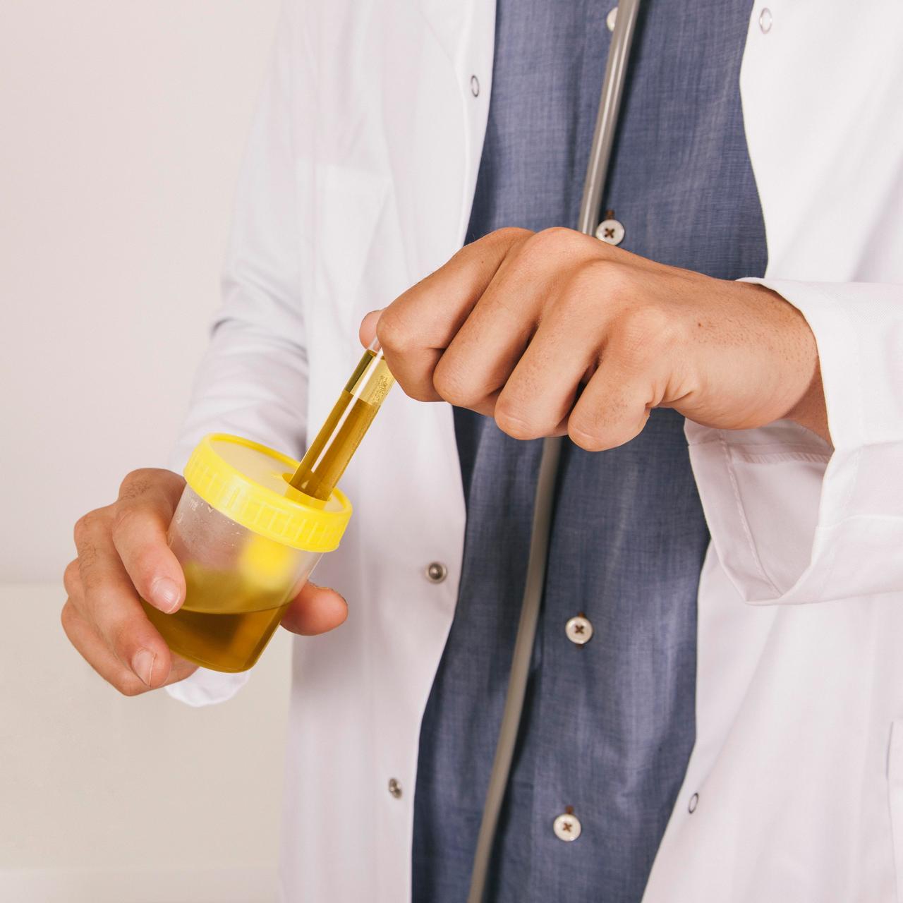 Free Urine Test
